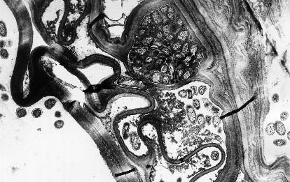 Inter- und intracelluläre Besiedlung lysierter Zellen durch 
Pantoea agglomerans, Maiswurzel (Cortex), 2,4-D-behandelt; © Jacobs / Hecht-Buchholz