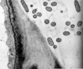 Oberflächenbesiedlung durch 
Pantoea agglomerans, Maiswurzel (Epidermis); © Jacobs / Hecht-Buchholz
